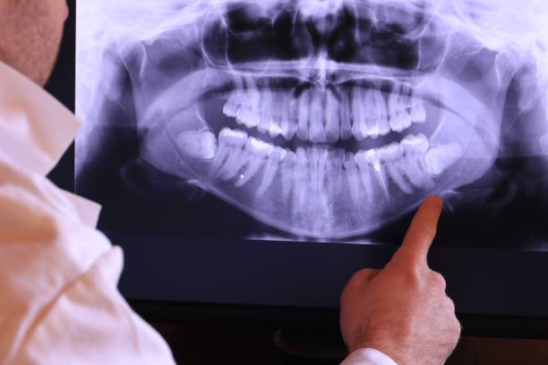 Best Emergency TMJ Treatment in Gruver, TX
