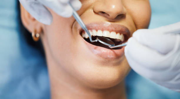 Best Same-Day Emergency Dental Services in Gruver, TX