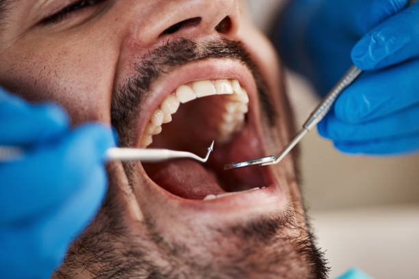 Best Emergency Dental Care for Broken or Chipped Teeth in Gruver, TX