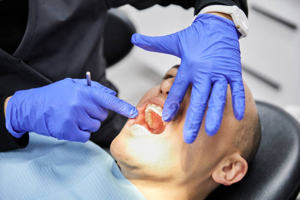 Best Emergency Tooth Extraction in Gruver, TX